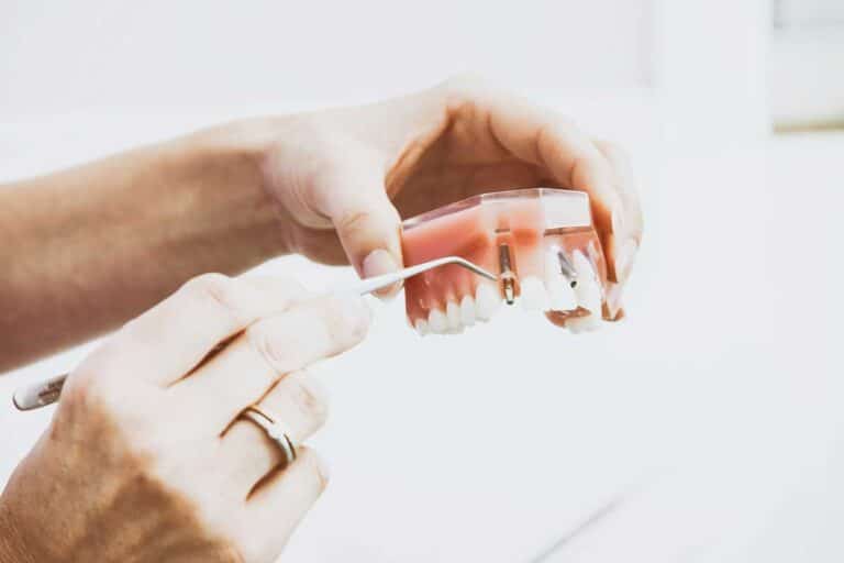 image of dental implant model, dental implants avaliable at skipton road dental, colne
